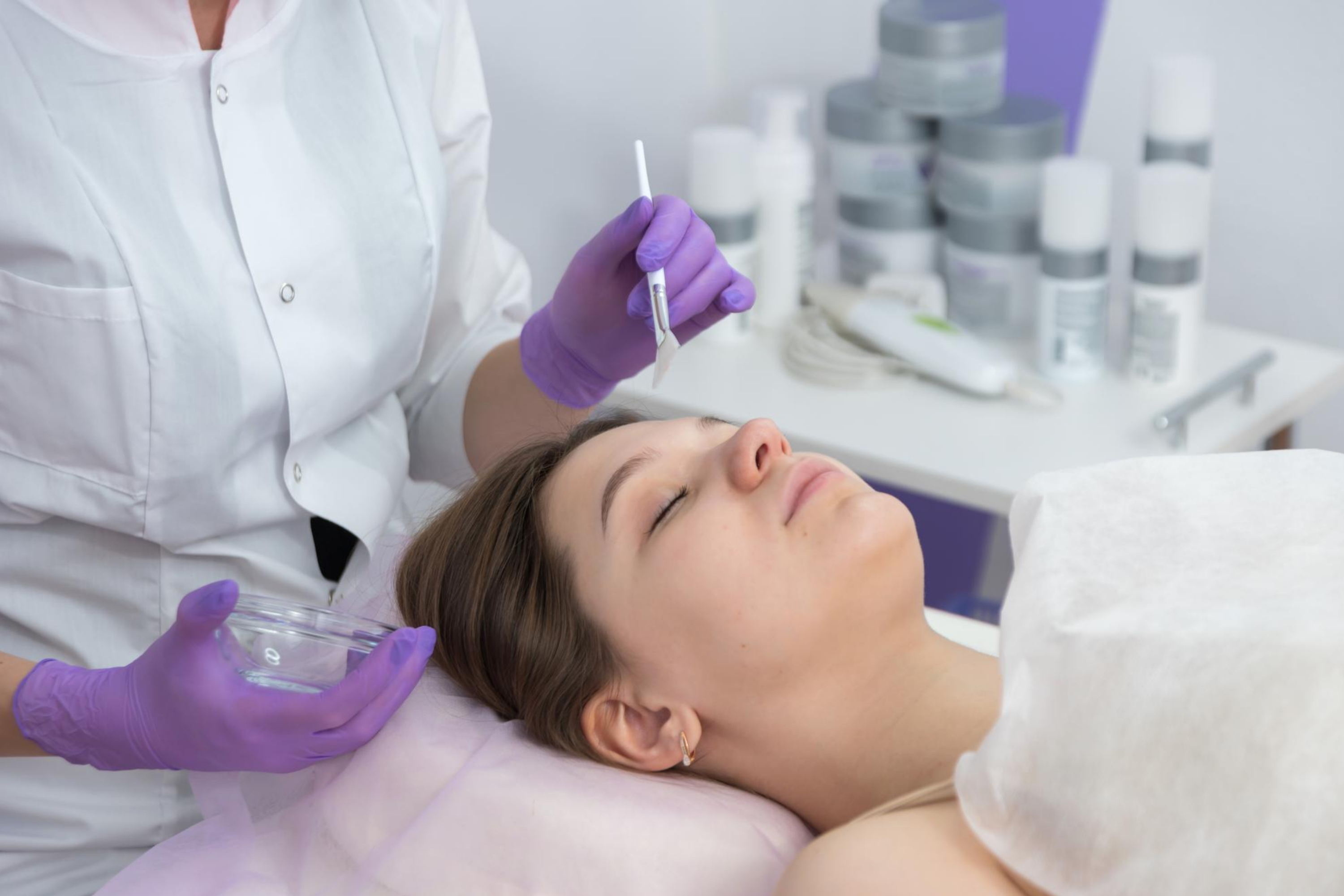 best-chemical-peels-la