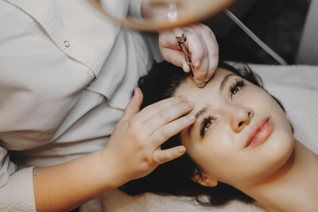 microneedling for acne scars los angeles